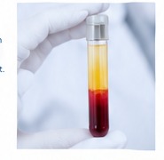 Aufbereitung von Blut für eine PRP-Behandlung